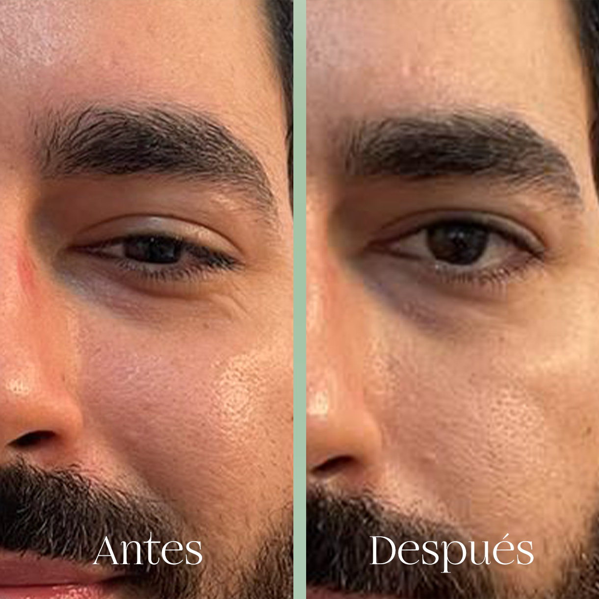 Masaje Facial Blefaro-Lift Facial