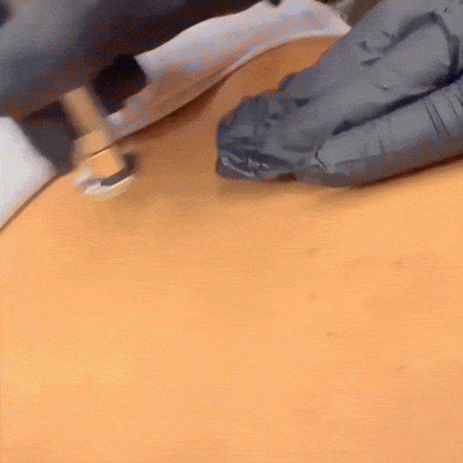 Microdermoabrasión y Limpieza de Espalda