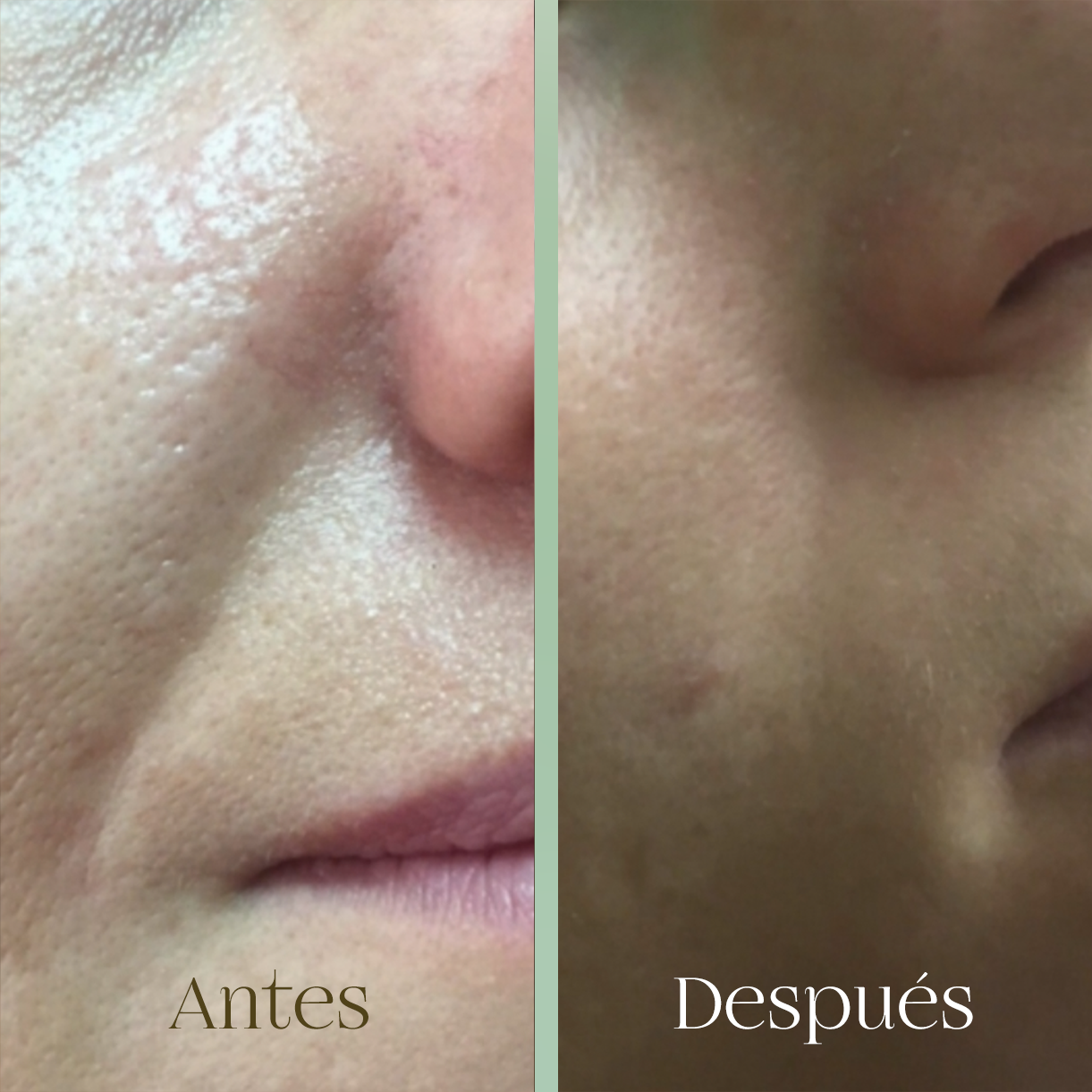 Masaje Facial Linfodrenante + Escultural