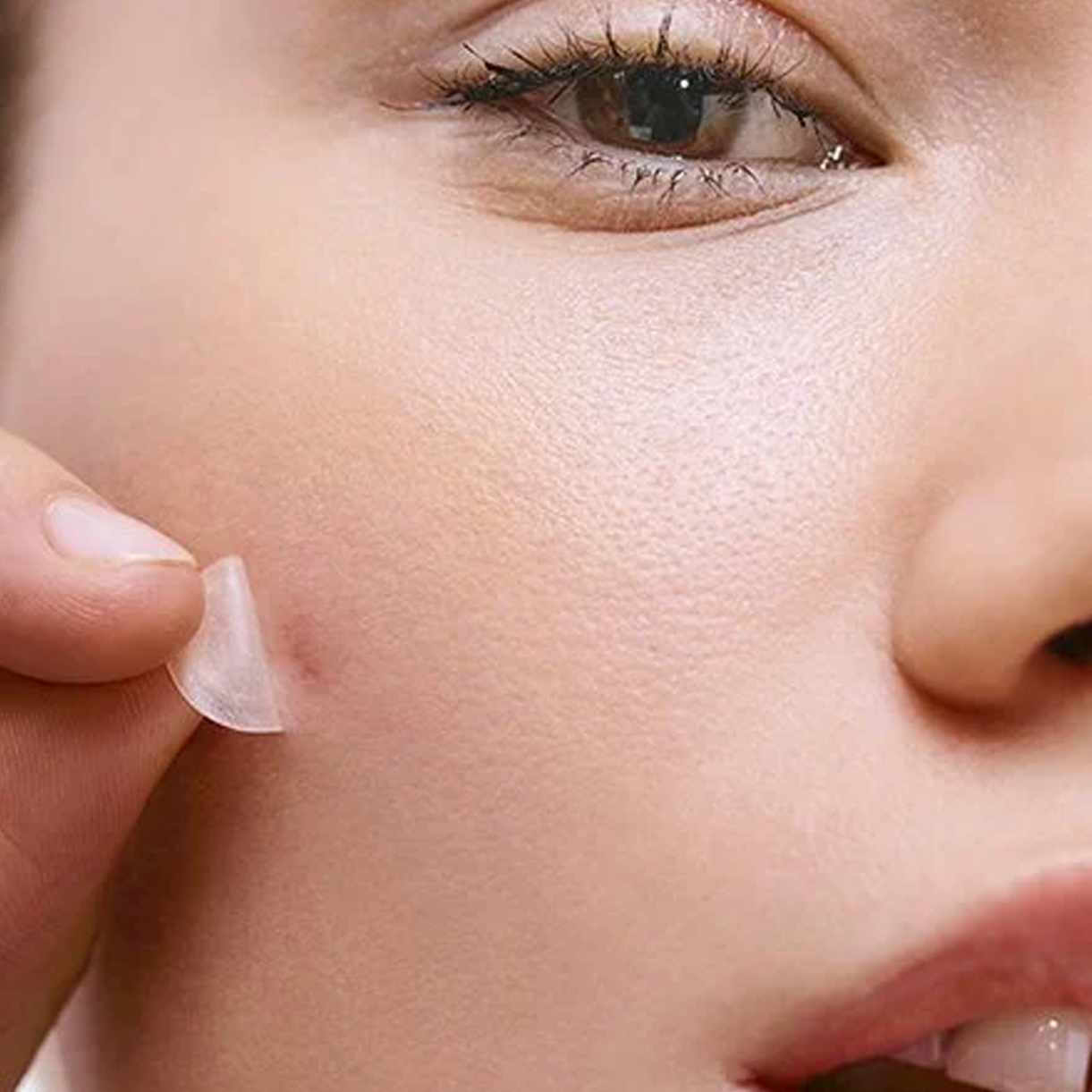Pimple Patches